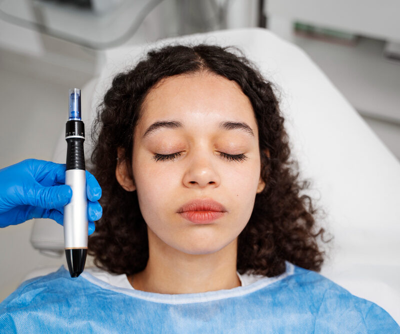 Microneedling has become one of the most widely recommended non-invasive aesthetic treatments for improving skin quality, texture, and tone.